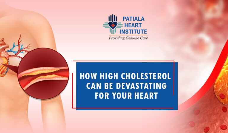 High cholesterol for heart