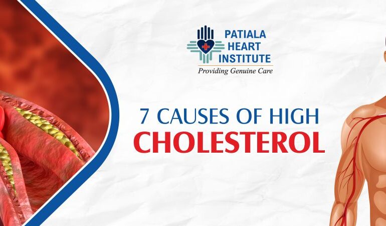 Causes of High Cholestrol