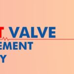 Hypertension(High BP): Causes, Symptoms, Treatment