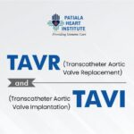 Reason for Heart Attack at Young Age