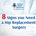 10 Myths And Facts About Knee Replacement Surgery