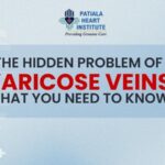 Lifestyle Changes To Be Adopted After Angioplasty