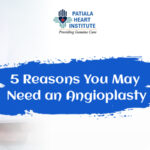 Lifestyle Changes To Be Adopted After Angioplasty