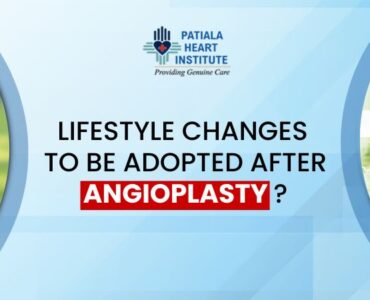 angioplasty