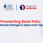 Understanding Stroke in Young Adults: What Causes It, Risks, and How to Prevent