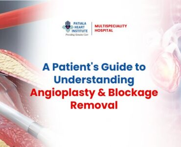Angioplasty and Blockage Removal