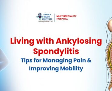 Ankylosing Spondylitis