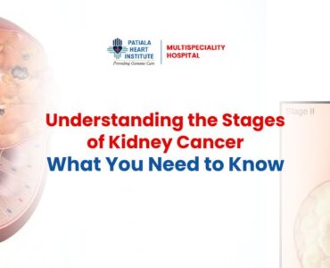 Kidney Cancer