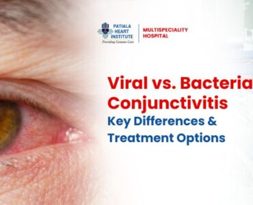 Bacterial Conjunctivitis