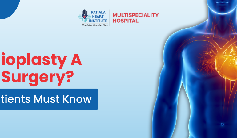 Is Angioplasty A Major Surgery?
