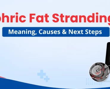 Perinephric Fat Stranding