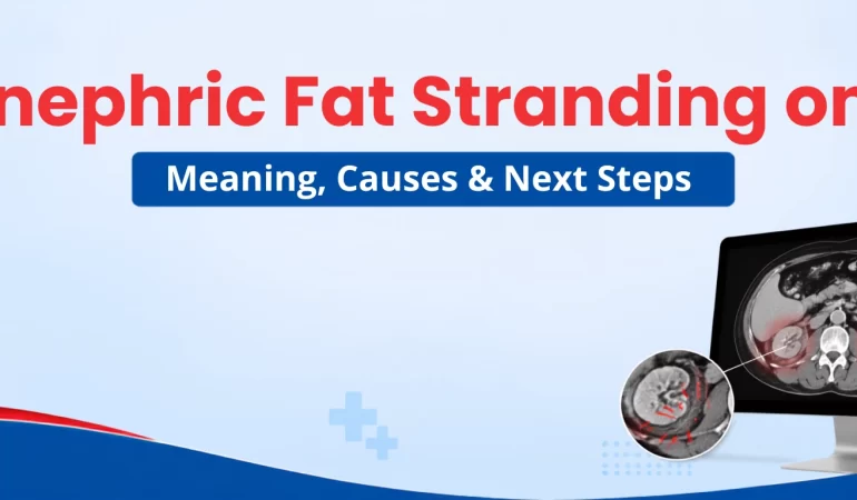 Perinephric Fat Stranding