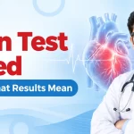90 Percent Blockage in Heart: How Serious Is It?