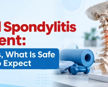 cervical spondylitis treatment