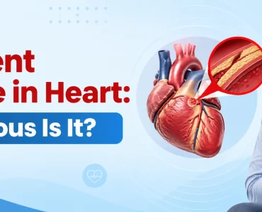 90 percent blockage in heart