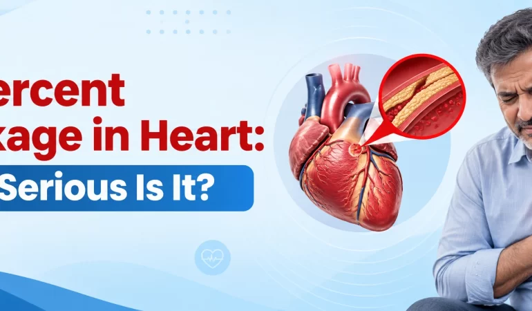 90 percent blockage in heart